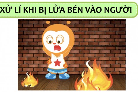 XỬ LÝ KHI BỊ LỬA BÉN VÀO NGƯỜI CÙNG POKI