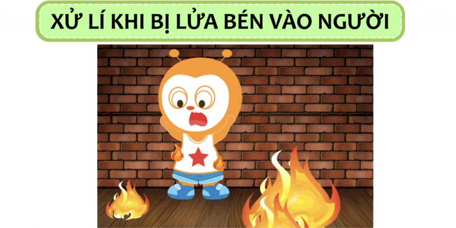 XỬ LÝ KHI BỊ LỬA BÉN VÀO NGƯỜI CÙNG POKI